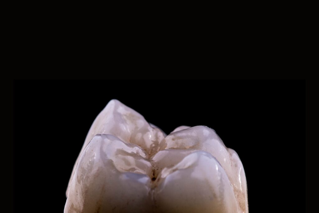 έμφραξη πρώτη Δημητρακόπουλος